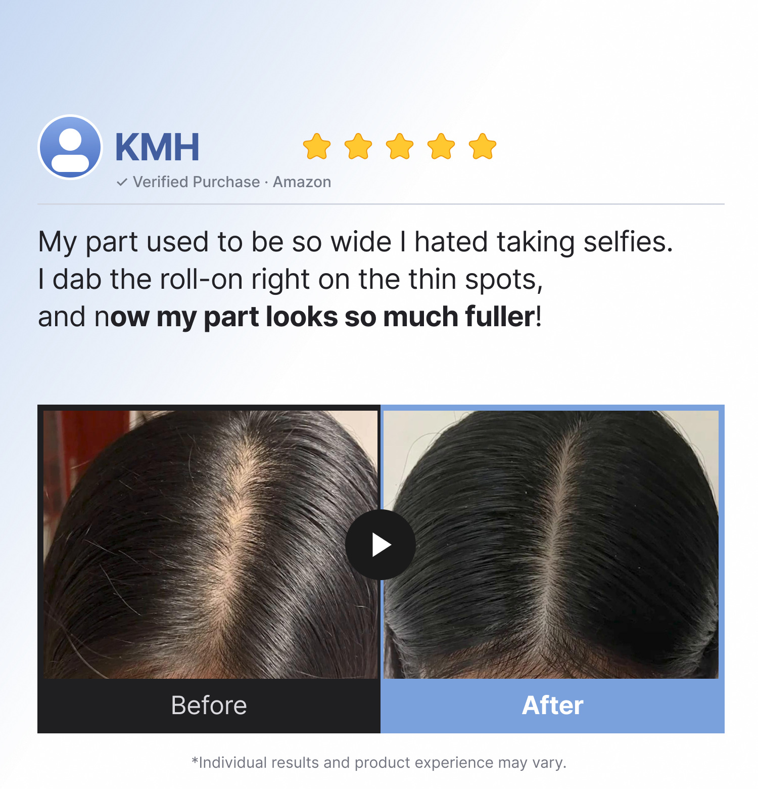 [Refilled] Intensive Hair Growth Set detail 1