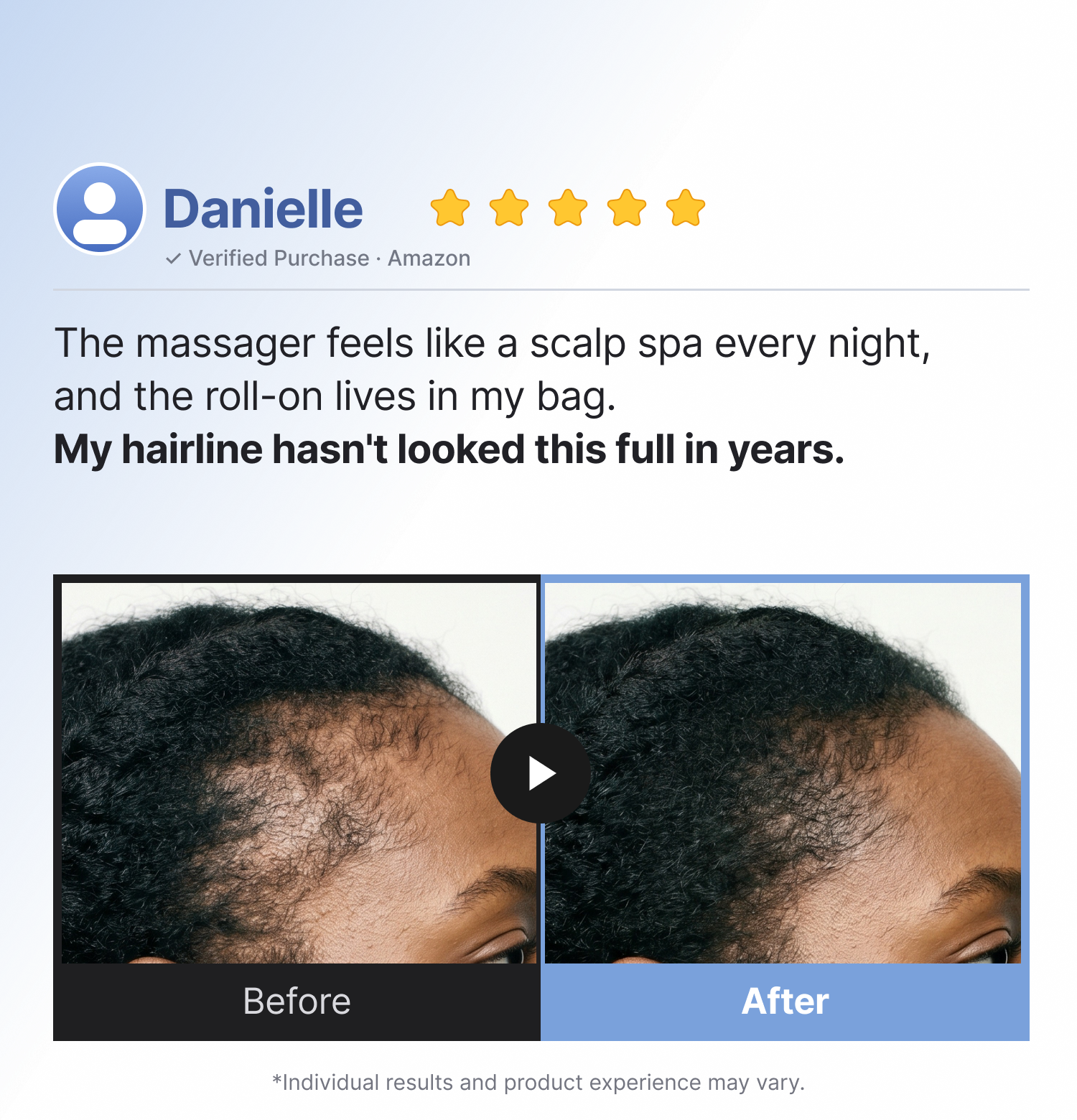 [Refilled] Intensive Hair Growth Set detail 2