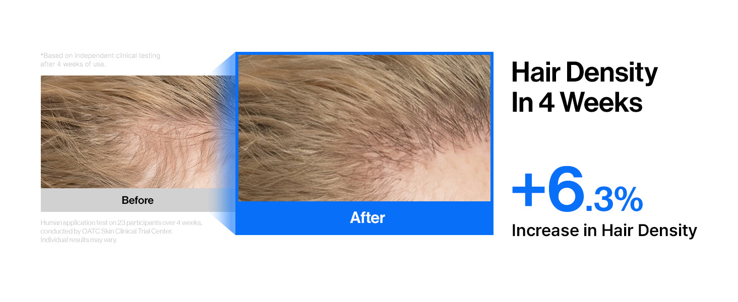 Intensive cADPR™ Hair Growth Serum detail 5