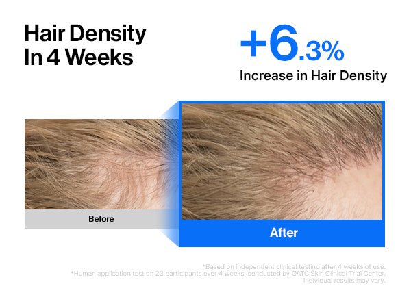 Intensive cADPR™ Hair Growth Serum detail 5
