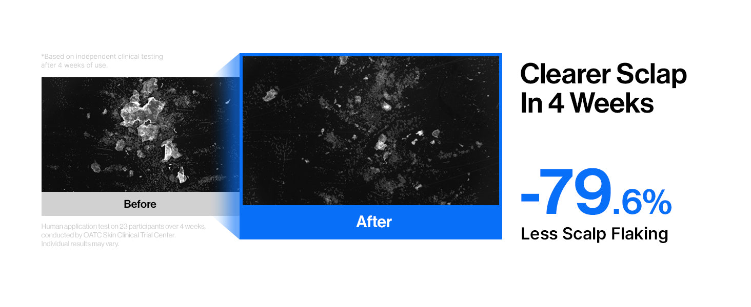 Intensive cADPR™ Hair Growth Serum detail 6