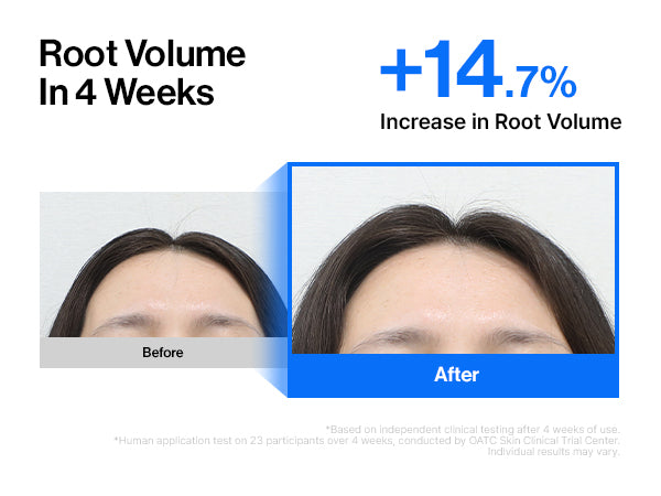 Intensive cADPR™ Hair Growth Serum detail 7
