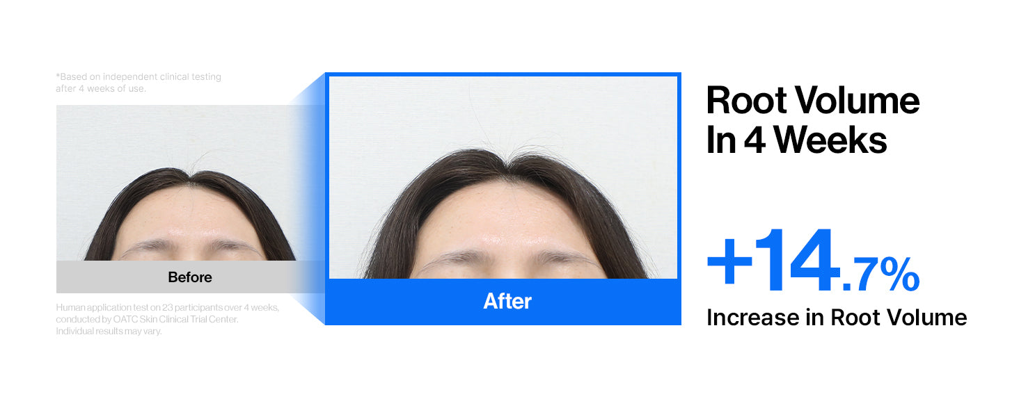 Intensive cADPR™ Hair Growth Serum detail 7