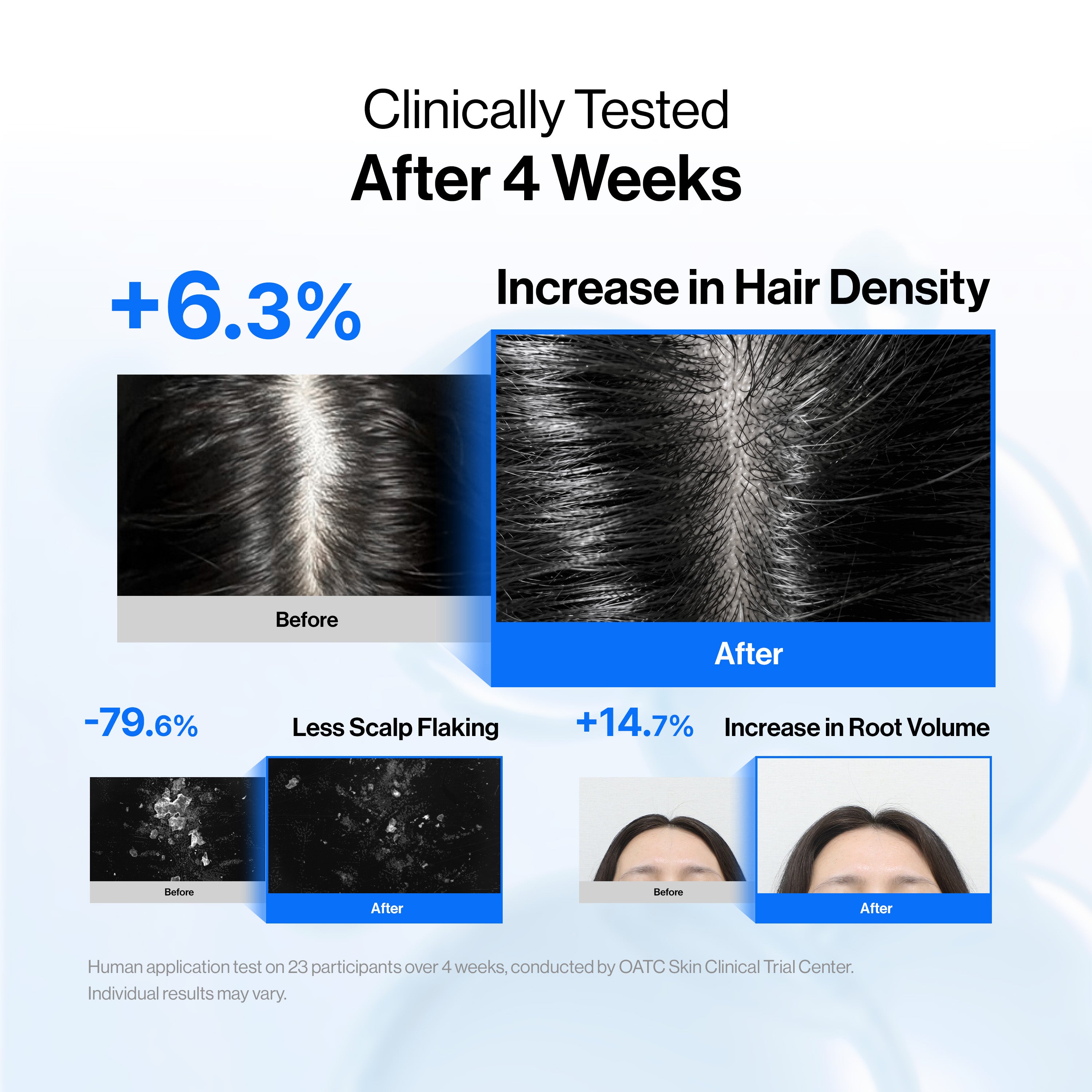 Intensive cADPR™ Hair Growth Serum view 4