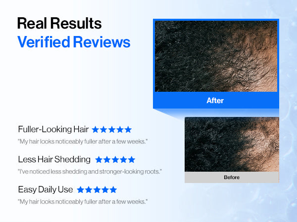 Intensive cADPR™ Hair Growth Serum detail 13